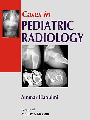 Cases in Pediatric Radiology - Haouimi, Ammar