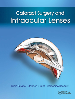 Cataract Surgery and Intraocular Lenses - Buratto, Lucio, Dr., MD, and Brint, Stephen, MD, and Boccuzzi, Domenico, MD