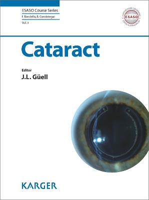 Cataract - Guell J L Ed