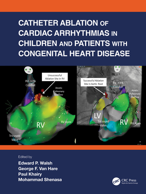 Catheter Ablation of Cardiac Arrhythmias in Children and Patients with Congenital Heart Disease - Walsh, Edward P (Editor), and Hare, George F Van (Editor), and Khairy, Paul (Editor)