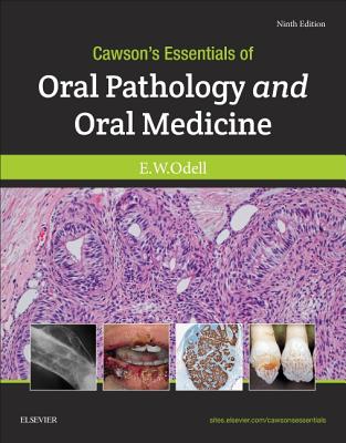 Cawson's Essentials of Oral Pathology and Oral Medicine - Odell, Edward W, Msc, PhD