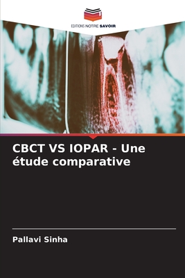 CBCT VS IOPAR - Une ?tude comparative - Sinha, Pallavi