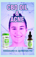 CBD Oil and Acne: All You Need to Know about the CBD Oil (the Perfect Cure for Acne)