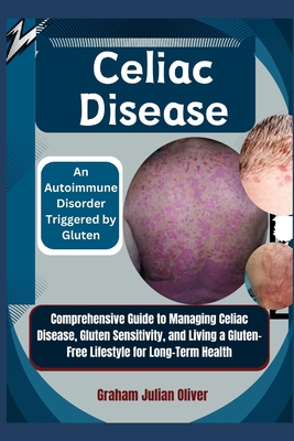 Celiac Disease: An Autoimmune Disorder Triggered by Gluten: Comprehensive Guide to Managing Celiac Disease, Gluten Sensitivity, and Living a Gluten-Free Lifestyle for Long-Term Health - Julian Oliver, Graham