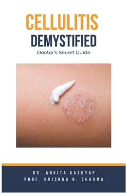 Cellulitis Demystified: Doctor's Secret Guide - Kashyap, Ankita, Dr., and Sharma, Prof Krishna N