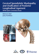 Cervical Spondylotic Myelopathy and Ossification of Posterior Longitudinal Ligament: Wfns Spine Committee Book