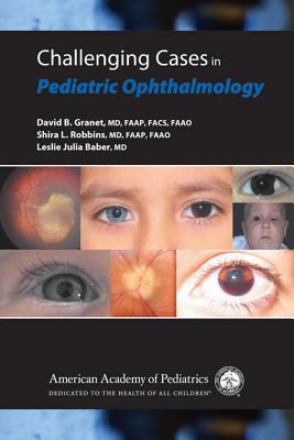 Challenging Cases in Pediatric Ophthalmology - Granet, David B