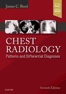 Chest Radiology: Patterns and Differential Diagnoses