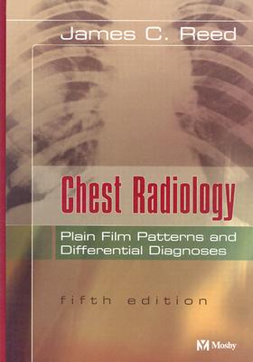 Chest Radiology: Plain Film Patterns and Differential Diagnoses - Reed, James C