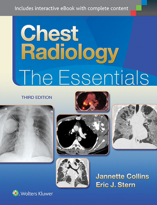 Chest Radiology: The Essentials - Collins, Janette, and Stern, Eric J, MD