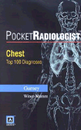 Chest: Top 100 Diagnoses