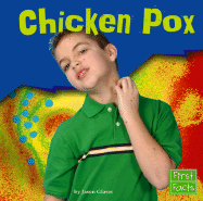 Chicken Pox