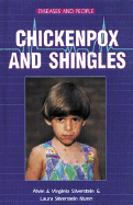 Chickenpox and Shingles