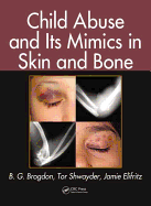 Child Abuse and its Mimics in Skin and Bone