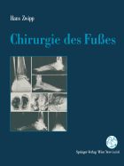 Chirurgie Des Fues