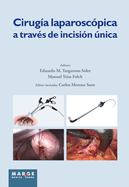 Ciruga laparoscpica a travs de incisin nica