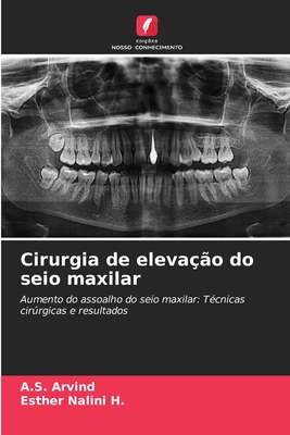 Cirurgia de eleva??o do seio maxilar - Arvind, A S, and Nalini H, Esther