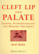 Cleft Lip and Palate: Examination, Surgery and Rehabilitation - Malek, Rene