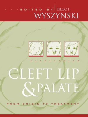 Cleft Lip and Palate: From Origin to Treatment - Wyszynski, Diego F (Editor)