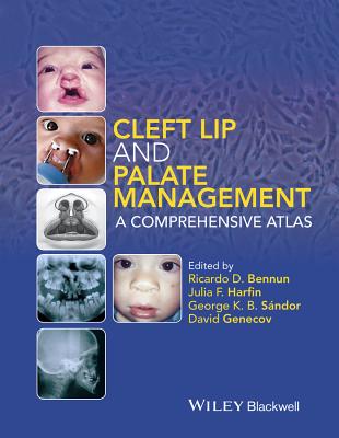 Cleft Lip and Palate Management: A Comprehensive Atlas - Bennun, Ricardo D. (Editor), and Harfin, Julia F. (Editor), and Sndor, George K. B.