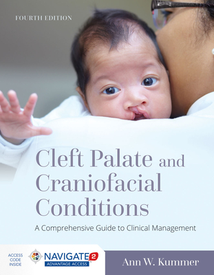 Cleft Palate and Craniofacial Conditions: A Comprehensive Guide to Clinical Management: A Comprehensive Guide to Clinical Management - Kummer, Ann W