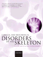 Clinical and Biochemical Disorders of the Skeleton