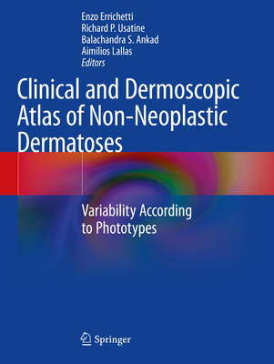 Clinical and Dermoscopic Atlas of Non-Neoplastic Dermatoses: Variability According to Phototypes - Errichetti, Enzo (Editor), and Usatine, Richard P. (Editor), and Ankad, Balachandra S. (Editor)