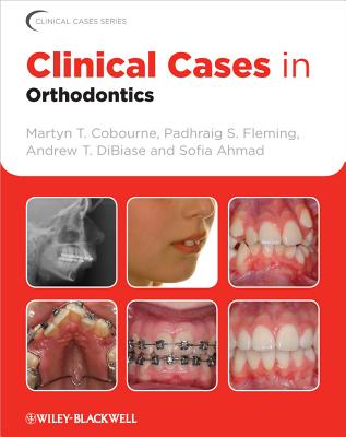 Clinical Cases in Orthodontics - Cobourne, Martyn T., and Fleming, Padhraig S., and DiBiase, Andrew T.