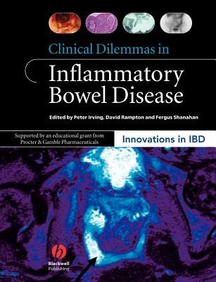 Clinical Dilemmas in Inflammatory Bowel Disease - Irving, Peter (Editor), and Rampton, David (Editor), and Shanahan, Fergus (Editor)