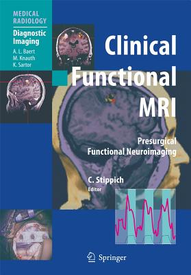 Clinical Functional MRI: Presurgical Functional Neuroimaging - Stippich, Christoph (Editor), and Sartor, K (Foreword by)