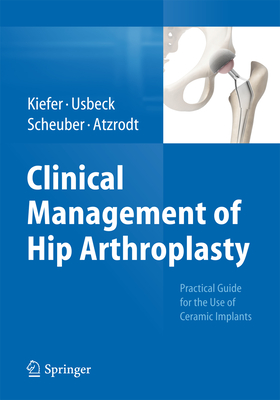 Clinical Management of Hip Arthroplasty: Practical Guide for the Use of Ceramic Implants - Kiefer, Hartmuth