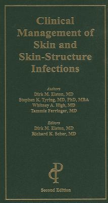 Clinical Management of Skin and Skin-Structure Infections - Elston, Dirk M