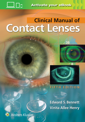 Clinical Manual of Contact Lenses - Bennett, Edward S, Od, and Henry, Vinita Allee, Od