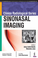 Clinico Radiological Series: Sinonasal Imaging