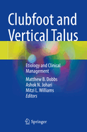 Clubfoot and Vertical Talus: Etiology and Clinical Management