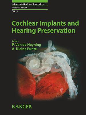 Cochlear Implants and Hearing Preservation - Van de Heyning, P. (Editor), and Kleine Punte, A. (Editor), and Bradley, Patrick J. (Series edited by)