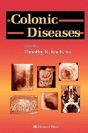 Colonic Diseases - Koch, Timothy R (Editor)