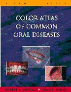 Color Atlas of Common Oral Diseases - Langlais, Robert P, Dds, PhD, MS, and Miller, Craig S, Dr.