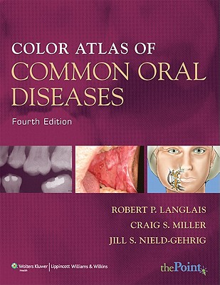 Color Atlas of Common Oral Diseases - Langlais, Robert P, Dds, PhD, MS, and Miller, Craig S, Dr., and Gehrig, Jill S, Ma