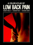Color Atlas of Low Back Pain
