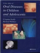 Color atlas of oral diseases in children and adolescents