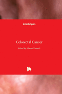 Colorectal Cancer