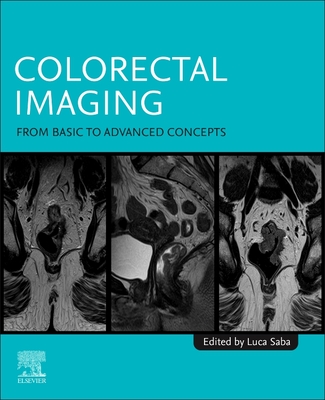 Colorectal Imaging: From Basic to Advanced Concepts - Saba, Luca, MD (Editor)