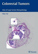 Colorectal Tumors - Tot, Tibor