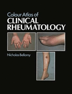 Colour Atlas of Clinical Rheumatology - Bellamy, N