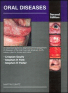 Colour Guide to Oral Diseases: An Illustrated Guide to Diagnosis and Management