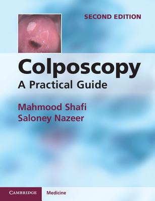 Colposcopy: A Practical Guide - Shafi, Mahmood, and Nazeer, Saloney