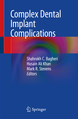 Complex Dental Implant Complications - Bagheri, Shahrokh C (Editor), and Khan, Husain Ali (Editor), and Stevens, Mark R (Editor)