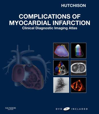 Complications of Myocardial Infarction: Clinical Diagnostic Imaging - Hutchison, Stuart J