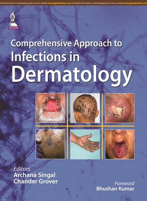 Comprehensive Approach to Infections in Dermatology - Singal, Archana, and Grover, Chander